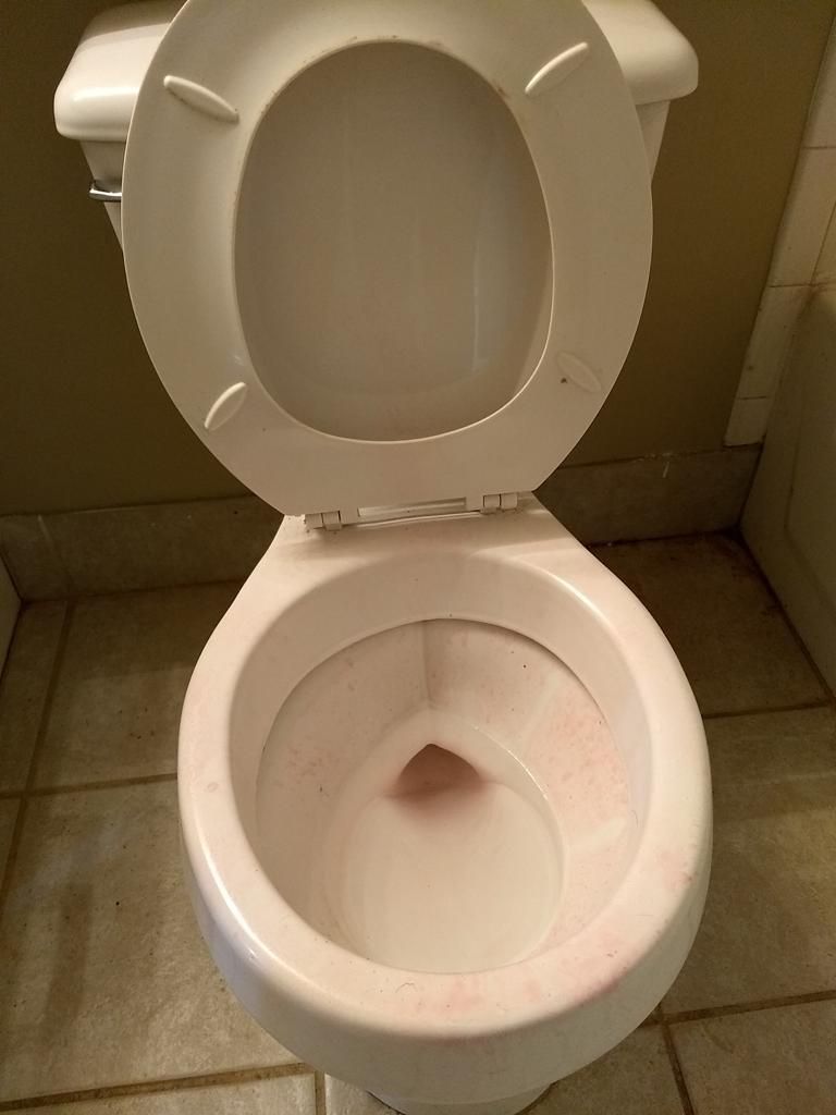 Stained toilet before cleaning